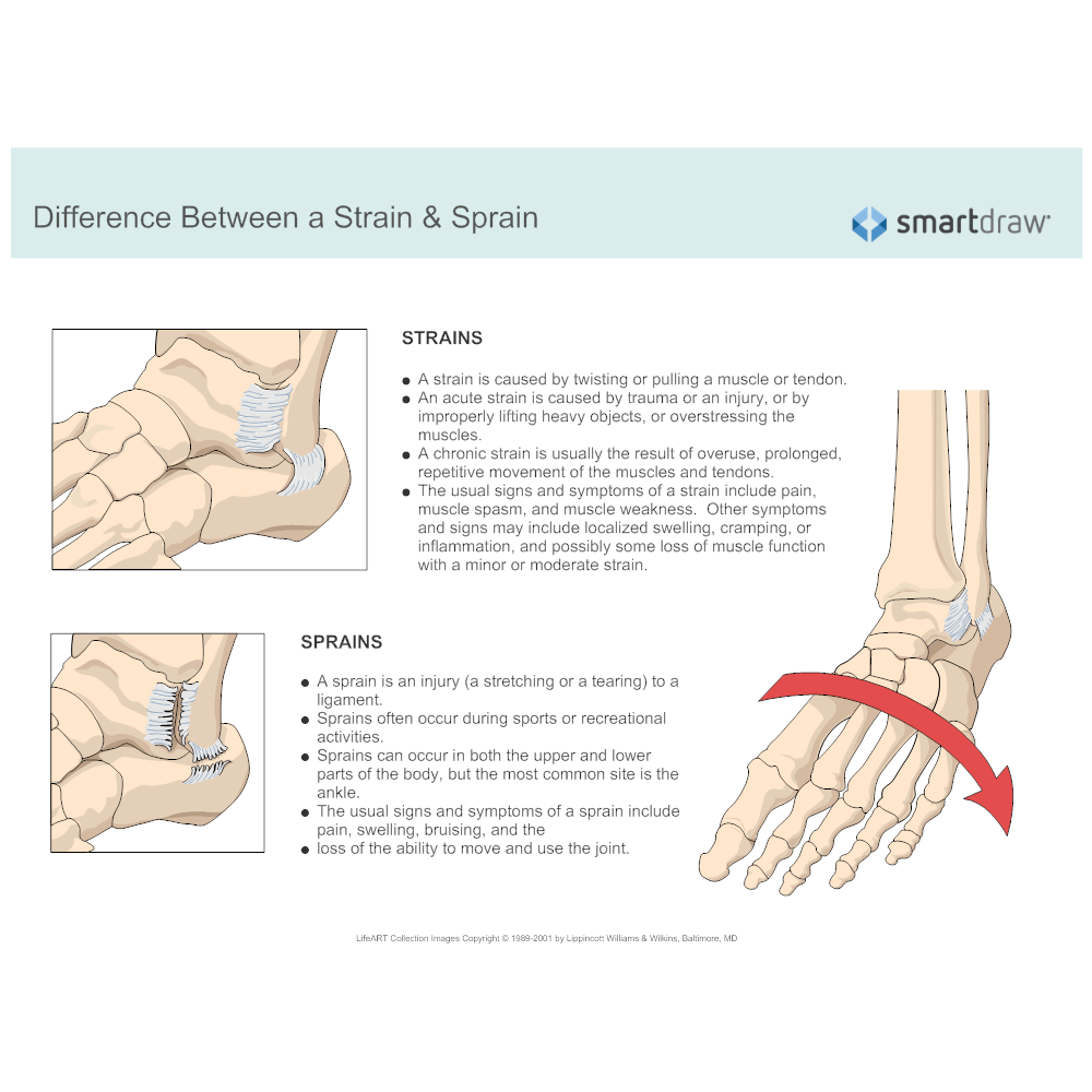 Difference Between a Strain and Sprain
